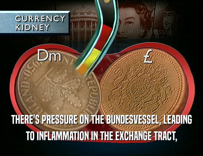 THERE'S PRESSURE ON THE BUNDESVESSEL, LEADING TO INFLAMMATION IN THE EXCHANGE TRACT, 
