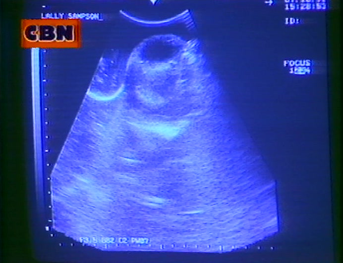AMONG THE THOUSANDS OF PARENTS FORKING OUT FOR THIS FLEXIBLE FOETUS 
