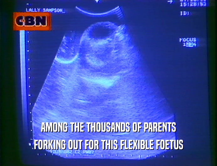 AMONG THE THOUSANDS OF PARENTS
 FORKING OUT FOR THIS FLEXIBLE FOETUS
 
