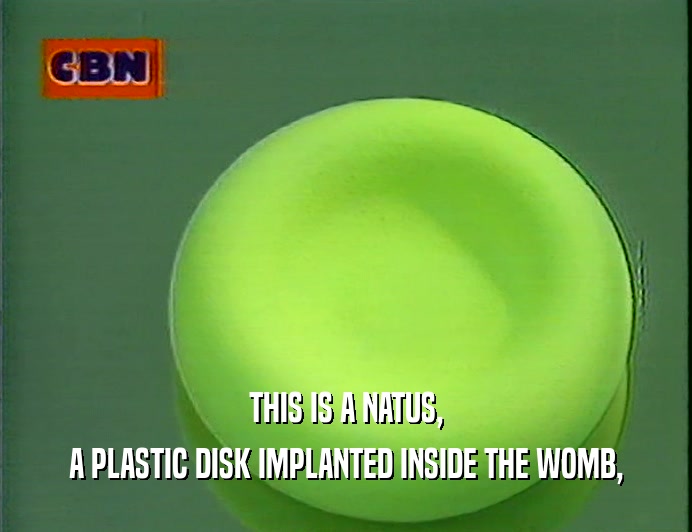 THIS IS A NATUS,
 A PLASTIC DISK IMPLANTED INSIDE THE WOMB,
 