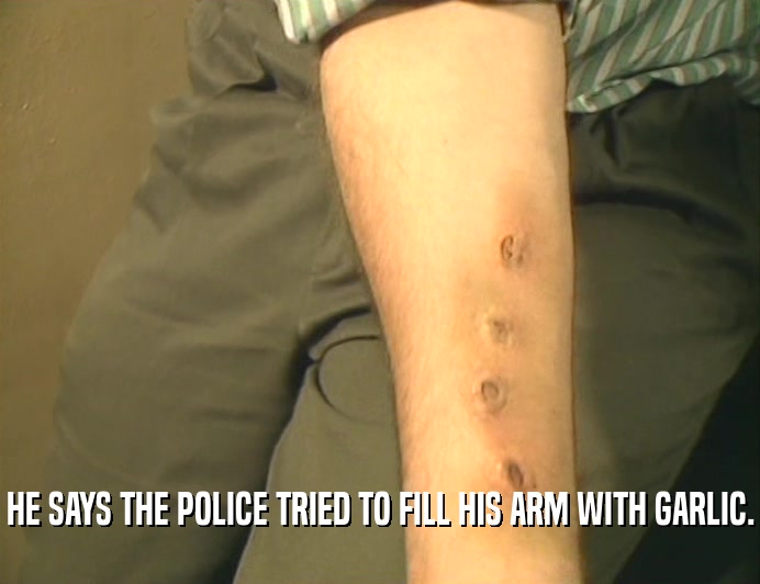 HE SAYS THE POLICE TRIED TO FILL HIS ARM WITH GARLIC.
  