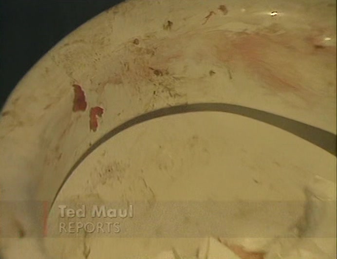 THE NEXT DETAINEE COMPLAINS OF A DRAIN BLOCKED WITH BLOOD, AND FAT ON HIS FLOOR. 