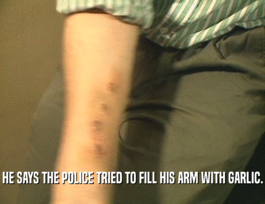 HE SAYS THE POLICE TRIED TO FILL HIS ARM WITH GARLIC.  