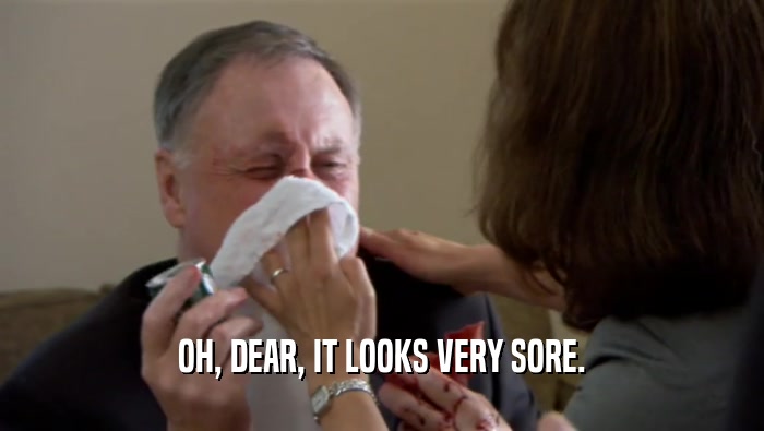 OH, DEAR, IT LOOKS VERY SORE.  