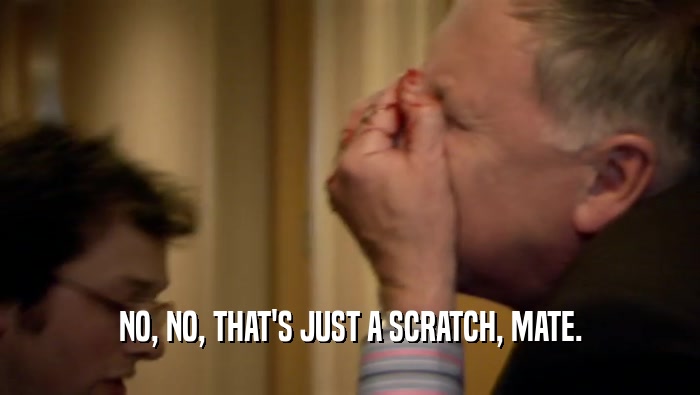 NO, NO, THAT'S JUST A SCRATCH, MATE.  