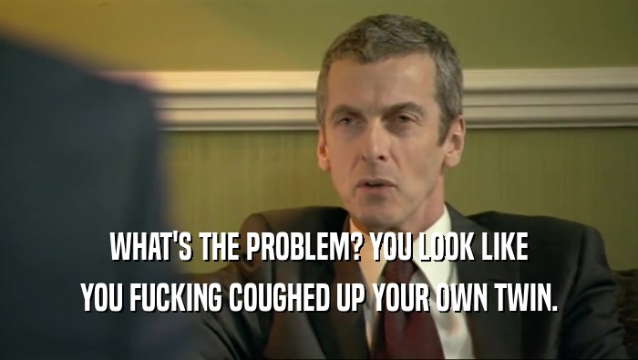 WHAT'S THE PROBLEM? YOU LOOK LIKE YOU FUCKING COUGHED UP YOUR OWN TWIN. 