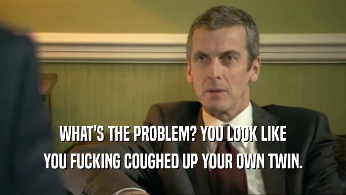 WHAT'S THE PROBLEM? YOU LOOK LIKE YOU FUCKING COUGHED UP YOUR OWN TWIN. 