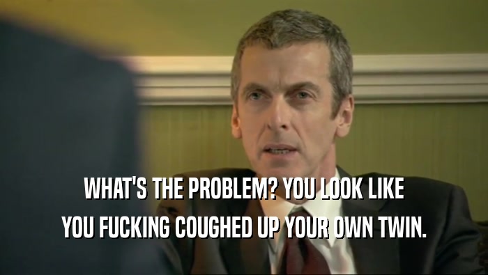 WHAT'S THE PROBLEM? YOU LOOK LIKE YOU FUCKING COUGHED UP YOUR OWN TWIN. 