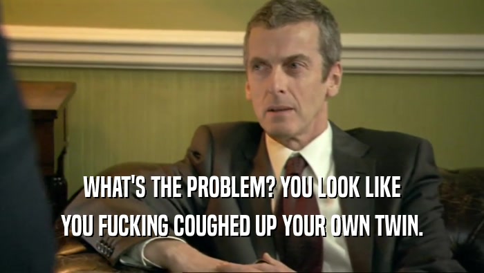 WHAT'S THE PROBLEM? YOU LOOK LIKE YOU FUCKING COUGHED UP YOUR OWN TWIN. 